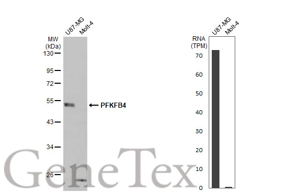 Various whole cell extracts (30 μg) were separated by 10% SDS-PAGE, and the membrane was blotted with PFKFB4 antibody (GTX107755) diluted at 1:1000. The HRP-conjugated anti-rabbit IgG antibody (GTX213110-01) was used to detect the primary antibody. Corresponding RNA expression data for the same cell lines are based on Human Protein Atlas program. Various whole cell extracts (30 μg) were separated by 10% SDS-PAGE, and the membrane was blotted with PFKFB4 antibody (GTX107755) diluted at 1:1000. The HRP-conjugated anti-rabbit IgG antibody (GTX213110-01) was used to detect the primary antibody. Corresponding RNA expression data for the same cell lines are based on Human Protein Atlas program.