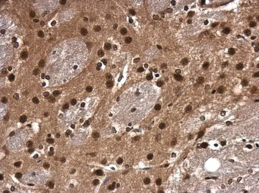 CDK9 antibody [N3C3] detects CDK9 protein at cytoplasm and nucleus in mouse brain by immunohistochemical analysis. Sample: Paraffin-embedded mouse brain. CDK9 antibody [N3C3] (GTX107758) diluted at 1:500. 
 Antigen Retrieval: Citrate buffer, pH 6.0, 15 min