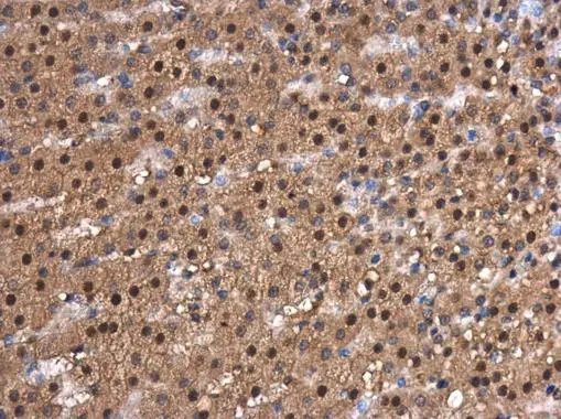 CDK9 antibody [N3C3] detects CDK9 protein at cytoplasm and nucleus in rat adrenal gland by immunohistochemical analysis. Sample: Paraffin-embedded rat adrenal gland. CDK9 antibody [N3C3] (GTX107758) diluted at 1:500. 
 Antigen Retrieval: Citrate buffer, pH 6.0, 15 min