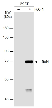 Non-transfected (–) and transfected (+) 293T whole cell extracts (30 μg) were separated by 7.5% SDS-PAGE, and the membrane was blotted with Raf1 antibody [N3C3] (GTX107763) diluted at 1:1000. The HRP-conjugated anti-rabbit IgG antibody (GTX213110-01) was used to detect the primary antibody.