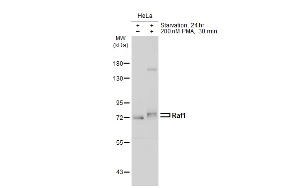 Untreated (–) and treated (+) HeLa whole cell extracts (30 μg) were separated by 7.5% SDS-PAGE, and the membrane was blotted with Raf1 antibody [N3C3] (GTX107763) diluted at 1:1000. The HRP-conjugated anti-rabbit IgG antibody (GTX213110-01) was used to detect the primary antibody.