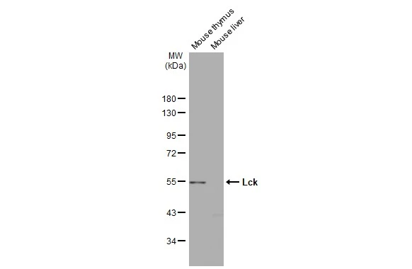 Various tissue extracts (30 μg) were separated by 10% SDS-PAGE, and the membrane was blotted with Lck antibody [N3C3] (GTX107785) diluted at 1:1000. The HRP-conjugated anti-rabbit IgG antibody (GTX213110-01) was used to detect the primary antibody.