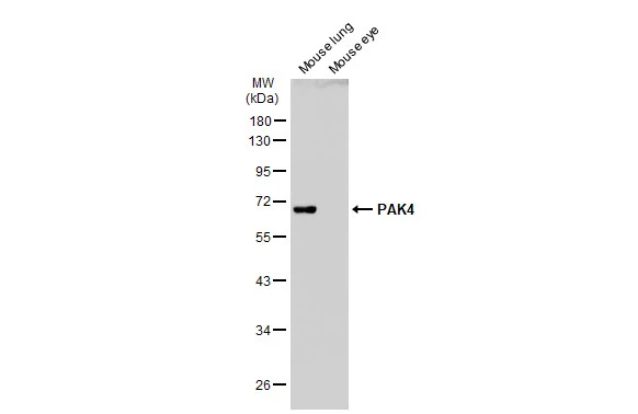 Various tissue extracts (50 μg) were separated by 10% SDS-PAGE, and the membrane was blotted with PAK4 antibody [C1C3] (GTX107787) diluted at 1:500. The HRP-conjugated anti-rabbit IgG antibody (GTX213110-01) was used to detect the primary antibody.
