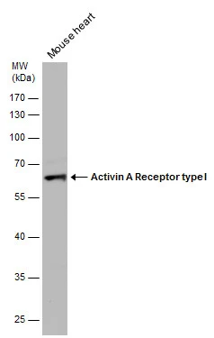 Mouse tissue extract (50 μg) was separated by 10% SDS-PAGE, and the membrane was blotted with Activin A Receptor type I antibody (GTX107815) diluted at 1:500.