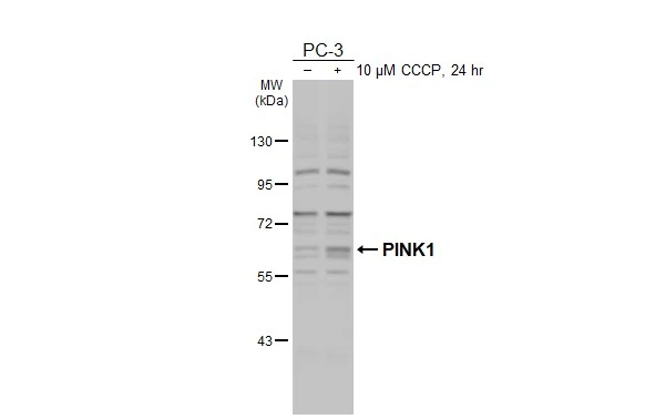 Untreated (–) and treated (+) PC-3 whole cell extracts (30 μg) were separated by 7.5% SDS-PAGE, and the membrane was blotted with PINK1 antibody [N3C3] (GTX107851) diluted at 1:1000. The HRP-conjugated anti-rabbit IgG antibody (GTX213110-01) was used to detect the primary antibody.