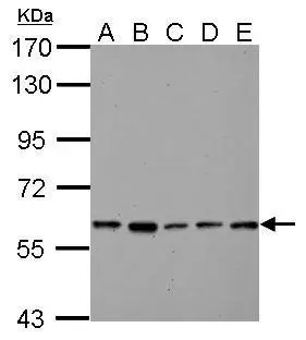Pyruvate Kinase (liver/RBC) antibody detects PKLR protein by Western blot analysis.