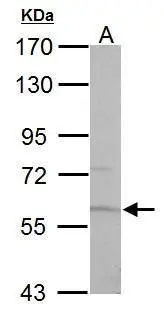 Pyruvate Kinase (liver/RBC) antibody detects PKLR protein by Western blot analysis. A. 50 μg mouse liver lysate/extract 7.5 % SDS-PAGE Pyruvate Kinase (liver/RBC) antibody (GTX107873) dilution: 1:500