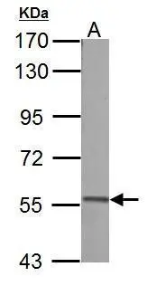 Pyruvate Kinase (liver/RBC) antibody detects PKLR protein by Western blot analysis. A. 50 μg Rat liver lysate/extract 7.5 % SDS-PAGE Pyruvate Kinase (liver/RBC) antibody (GTX107873) dilution: 1:500
