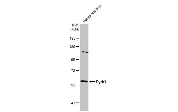 Mouse tissue extract (50 μg) was separated by 7.5% SDS-PAGE, and the membrane was blotted with Dyrk3 antibody (GTX107889) diluted at 1:1000. The HRP-conjugated anti-rabbit IgG antibody (GTX213110-01) was used to detect the primary antibody.