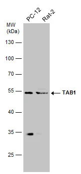 Various whole cell extracts (30 μg) were separated by 10% SDS-PAGE, and the membrane was blotted with TAB1 antibody (GTX107892) diluted at 1:500.