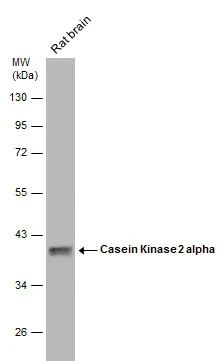 Rat tissue extract (50 μg) was separated by 10% SDS-PAGE, and the membrane was blotted with Casein Kinase 2 alpha antibody (GTX107897) diluted at 1:1000. The HRP-conjugated anti-rabbit IgG antibody (GTX213110-01) was used to detect the primary antibody.