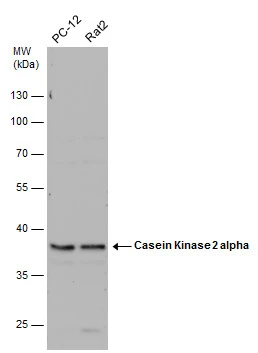 Various whole cell extracts (30 μg) were separated by 10% SDS-PAGE, and the membrane was blotted with Casein Kinase 2 alpha antibody (GTX107897) diluted at 1:1000. The HRP-conjugated anti-rabbit IgG antibody (GTX213110-01) was used to detect the primary antibody.