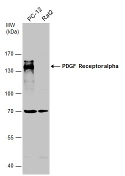 Various whole cell extracts (30 μg) were separated by 7.5% SDS-PAGE, and the membrane was blotted with PDGF Receptor alpha antibody [N2C2], Internal (GTX107903) diluted at 1:500.