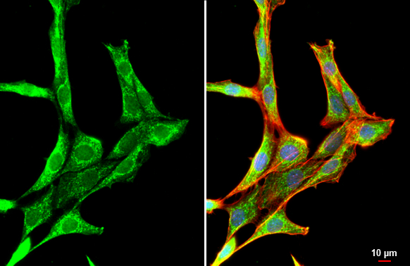 PDGF Receptor alpha antibody [N2C2], Internal detects PDGF Receptor alpha protein at cytoplasm by immunofluorescent analysis. Sample: NIH/3T3 cells were fixed in 4% paraformaldehyde at RT for 15 min. Green: PDGF Receptor alpha stained by PDGF Receptor alpha antibody [N2C2], Internal (GTX107903) diluted at 1:500. Red: phalloidin, a cytoskeleton marker diluted at 1:200. Blue: Hoechst 33342 staining.