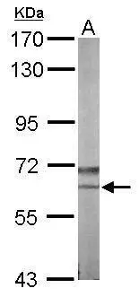 Sample (50 μg of whole cell lysate) A: Mouse brain 7.5% SDS PAGE GTX107910 diluted at 1:1000 The HRP-conjugated anti-rabbit IgG antibody (GTX213110-01) was used to detect the primary antibody.