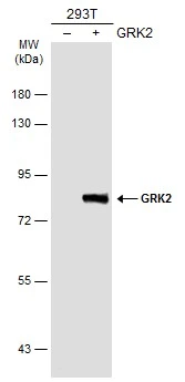 Non-transfected (–) and transfected (+) 293T whole cell extracts (30 μg) were separated by 7.5% SDS-PAGE, and the membrane was blotted with GRK2 antibody [N3C3-2] (GTX107915) diluted at 1:1000. The HRP-conjugated anti-rabbit IgG antibody (GTX213110-01) was used to detect the primary antibody.