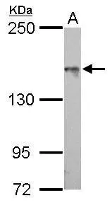 ASK1 antibody [C2C3-2], C-term detects MAP3K5 protein by Western blot analysis. A. 50 μg mouse lung lysate/extract 5 % SDS-PAGE ASK1 antibody [C2C3-2], C-term (GTX107921) dilution: 1:1000