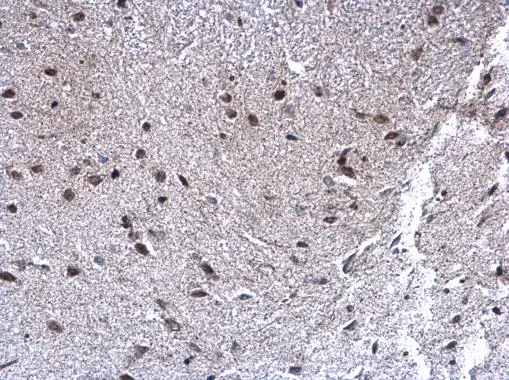 Selenophosphate synthetase 1 antibody detects Selenophosphate synthetase 1 protein at nucleus on mouse fore brain by immunohistochemical analysis. Sample: Paraffin-embedded mouse fore brain. Selenophosphate synthetase 1 antibody (GTX107924) diluted at 1:500. 
 Antigen Retrieval: Trilogy? (EDTA based, pH 8.0) buffer, 15min