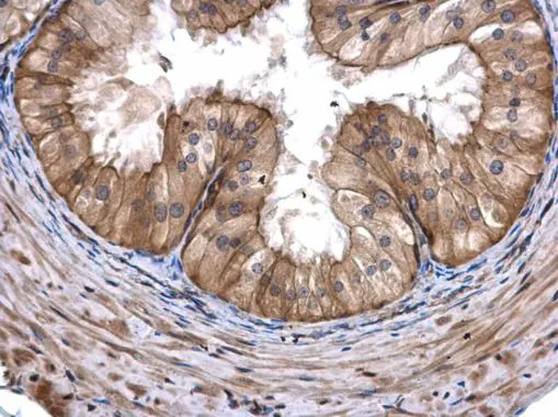 CoA synthase antibody [N3C3-3] detects CoA synthase protein at cytoplasm in mouse prostate by immunohistochemical analysis. Sample: Paraffin-embedded mouse prostate. CoA synthase antibody [N3C3-3] (GTX107934) diluted at 1:500. 
 Antigen Retrieval: Citrate buffer, pH 6.0, 15 min