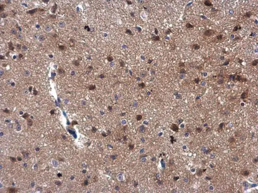 MEKK3 antibody [N3C3] detects MEKK3 protein at cytoplasm and nucleus in mouse brain by immunohistochemical analysis. Sample: Paraffin-embedded mouse brain. MEKK3 antibody [N3C3] (GTX107945) diluted at 1:500. 
 Antigen Retrieval: Citrate buffer, pH 6.0, 15 min