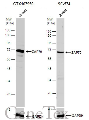 Whole cell extract (30 μg) was separated by 10% SDS-PAGE, and the membrane was blotted with ZAP70 antibody (GTX107950) diluted at 1:3000 and competitor's antibody (SC-574) diluted by 1:200.
