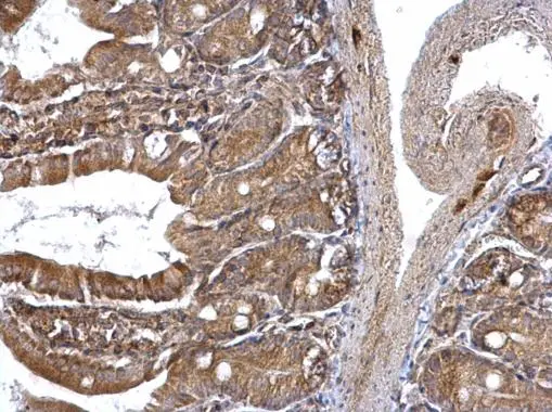ETEA antibody [C3], C-term detects ETEA protein at cytoplasm on mouse intestine by immunohistochemical analysis. Sample: Paraffin-embedded mouse intestine. ETEA antibody [C3], C-term (GTX107993) diluted at 1:500. 
 Antigen Retrieval: Trilogy? (EDTA based, pH 8.0) buffer, 15min