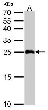 GSTA1 antibody detects GSTA1 protein by Western blot analysis. A. 50 μg mouse liver lysate/extract 12 % SDS-PAGE GSTA1 antibody (GTX108012) dilution: 1:5000