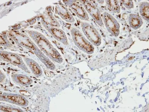 RBP1 antibody
