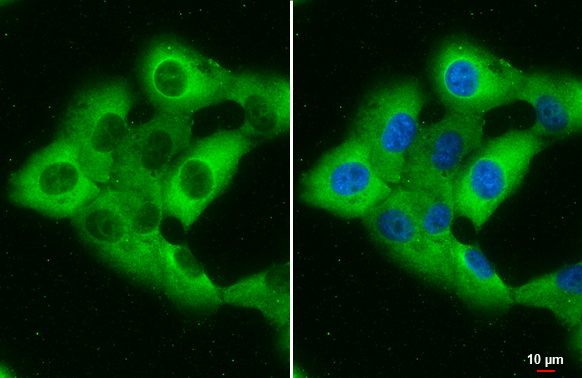 RBP1 antibody