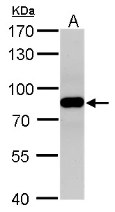 VPS35 antibody detects VPS35 protein by western blot analysis. A. 50 μg rat brain lysate/extract 7.5% SDS-PAGE VPS35 antibody (GTX108058) dilution: 1:500 The HRP-conjugated anti-rabbit IgG antibody (GTX213110-01) was used to detect the primary antibody.