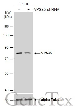 Non-transfected (–) and transfected (+) HeLa whole cell extracts (30 μg) were separated by 7.5% SDS-PAGE, and the membrane was blotted with VPS35 antibody [C3], C-term (GTX108058) diluted at 1:5000. The HRP-conjugated anti-rabbit IgG antibody (GTX213110-01) was used to detect the primary antibody.