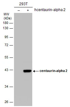 Non-transfected (–) and transfected (+) 293T whole cell extracts (30 μg) were separated by 10% SDS-PAGE, and the membrane was blotted with centaurin-alpha 2 antibody [C3], C-term (GTX108059) diluted at 1:5000.