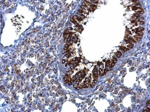 MTMR9 antibody [C3], C-term detects MTMR9 protein at cytoplasm on mouse lung by immunohistochemical analysis. Sample: Paraffin-embedded mouse lung. MTMR9 antibody [C3], C-term (GTX108078) diluted at 1:500. 
 Antigen Retrieval: Trilogy? (EDTA based, pH 8.0) buffer, 15min