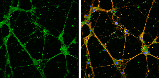EFHD2 antibody detects EFHD2 protein by immunofluorescent analysis. Sample: DIV14 rat E18 primary cortical neurons were fixed in 4% paraformaldehyde at RT for 15 min. Green: EFHD2 protein stained by EFHD2 antibody (GTX108080) diluted at 1:500. Red: beta Tubulin 3/ Tuj1, stained by beta Tubulin 3/ Tuj1 antibody [GT1338] (GTX631831) diluted at 1:500. Blue: Fluoroshield with DAPI (GTX30920).