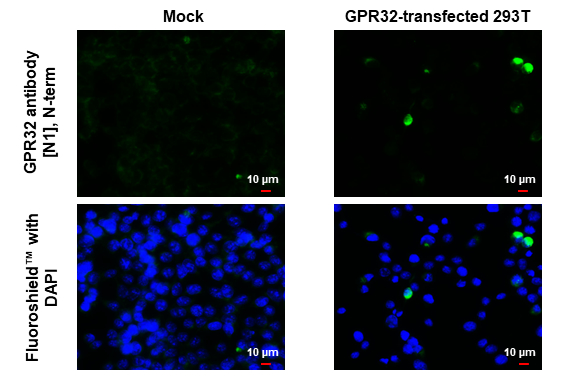GPR32 antibody [N1], N-term detects GPR32 protein by immunofluorescent analysis. Sample: Mock and transfected 293T cells were fixed in ice-cold MeOH for 5 min. Green: GPR32 stained by GPR32 antibody [N1], N-term (GTX108119) diluted at 1:500. Blue: Fluoroshield with DAPI (GTX30920).