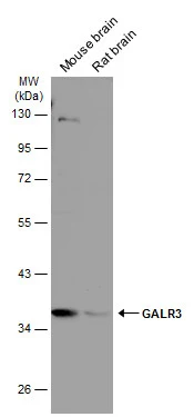 Various tissue extracts (50 μg) were separated by 10% SDS-PAGE, and the membrane was blotted with GALR3 antibody (GTX108163) diluted at 1:500. The HRP-conjugated anti-rabbit IgG antibody (GTX213110-01) was used to detect the primary antibody.
