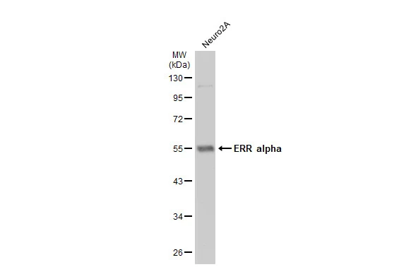 Whole cell extract (30 μg) was separated by 10% SDS-PAGE, and the membrane was blotted with ERR alpha antibody [N1], N-term (GTX108166) diluted at 1:500. The HRP-conjugated anti-rabbit IgG antibody (GTX213110-01) was used to detect the primary antibody.