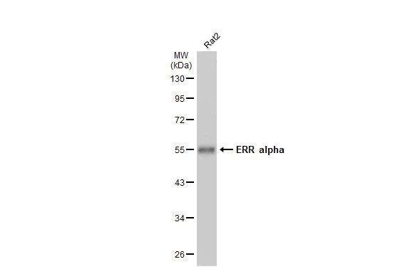 Whole cell extract (30 μg) was separated by 10% SDS-PAGE, and the membrane was blotted with ERR alpha antibody [N1], N-term (GTX108166) diluted at 1:500. The HRP-conjugated anti-rabbit IgG antibody (GTX213110-01) was used to detect the primary antibody, and the signal was developed with Trident ECL plus-Enhanced.