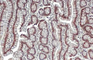 ERR alpha antibody [N1], N-term detects ERR alpha protein at nucleus by immunohistochemical analysis. Sample: Paraffin-embedded rat colon. ERR alpha stained by ERR alpha antibody [N1], N-term (GTX108166) diluted at 1:500. Antigen Retrieval: Citrate buffer, pH 6.0, 15 min
