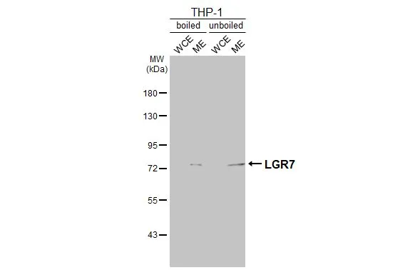 Boiled and unboiled THP-1 whole cell and membrane extracts (30 μg) were separated by 7.5% SDS-PAGE, and the membrane was blotted with LGR7 antibody [C3-2], C-term (GTX108186) diluted at 1:500. The HRP-conjugated anti-rabbit IgG antibody (GTX213110-01) was used to detect the primary antibody. (WCE: whole cell extract; ME: membrane extract)