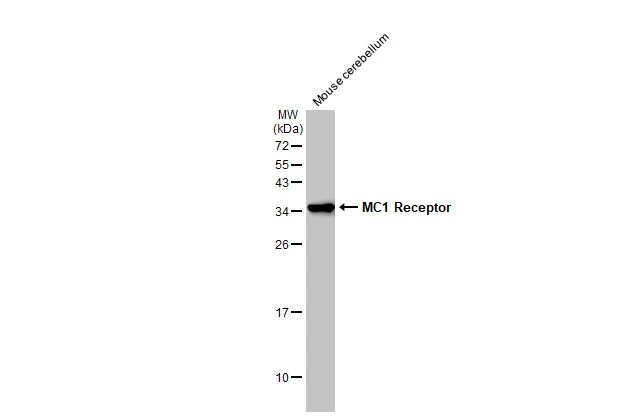 Mouse tissue extract (50 μg) was separated by 12% SDS-PAGE, and the membrane was blotted with MC1 Receptor antibody [C2C3], C-term (GTX108190) diluted at 1:4000. The HRP-conjugated anti-rabbit IgG antibody (GTX213110-01) was used to detect the primary antibody.