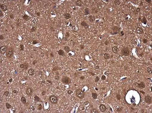 PTGFRN antibody [C3], C-term detects PTGFRN protein at cytoplasm in rat brain by immunohistochemical analysis. Sample: Paraffin-embedded rat brain. PTGFRN antibody [C3], C-term (GTX108209) diluted at 1:400. 
 Antigen Retrieval: Citrate buffer, pH 6.0, 15 min