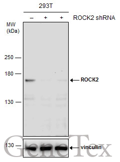 Non-transfected (–) and transfected (+) 293T whole cell extracts (30 μg) were separated by 5% SDS-PAGE, and the membrane was blotted with ROCK2 antibody [N3C1], Internal (GTX108247) diluted at 1:1000. The HRP-conjugated anti-rabbit IgG antibody (GTX213110-01) was used to detect the primary antibody.