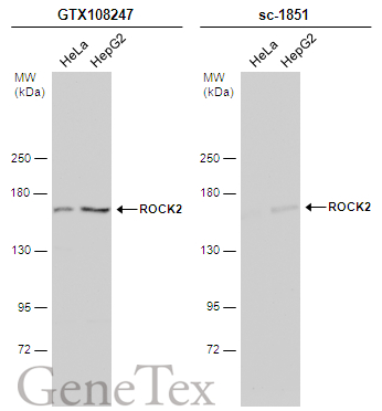 Various whole cell extracts (30 μg) were separated by 5% SDS-PAGE, and the membranes were blotted with ROCK2 antibody [N3C1], Internal (GTX108247) diluted at 1:500 and competitor's antibody (sc-1851) diluted at 1:500. The HRP-conjugated anti-rabbit IgG antibody (GTX213110-01) was used to detect the primary antibody. *The competitor is not affiliated with GeneTex and does not endorse this product.