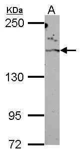 Sample (50 μg of whole cell lysate) A: Rat brain 5% SDS PAGE GTX108247 diluted at 1:1000 The HRP-conjugated anti-rabbit IgG antibody (GTX213110-01) was used to detect the primary antibody. Sample (50 μg of whole cell lysate) A: Rat brain 5% SDS PAGE GTX108247 diluted at 1:1000 The HRP-conjugated anti-rabbit IgG antibody (GTX213110-01) was used to detect the primary antibody.