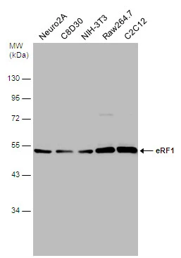 eRF1 antibody detects eRF1 protein at cytoplasm by immunofluorescent analysis.