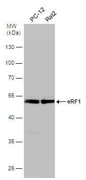Various whole cell extracts (30 μg) were separated by 10% SDS-PAGE, and the membrane was blotted with eRF1 antibody (GTX108271) diluted at 1:500.