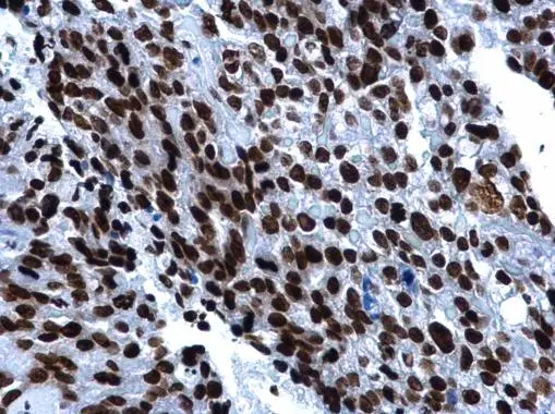 pollen様 Anti-Histone H2A.X antibody (GTX108272) | GeneTex
