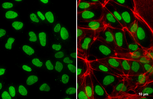 Histone H2A.Z antibody detects Histone H2A.Z protein at nucleus by immunofluorescent analysis. Sample: MDCK cells were fixed in 4% paraformaldehyde at RT for 15 min. Green: Histone H2A.Z stained by Histone H2A.Z antibody (GTX108273) diluted at 1:500. Red: phalloidin, a cytoskeleton marker, diluted at 1:100. Scale bar= 10 μm.