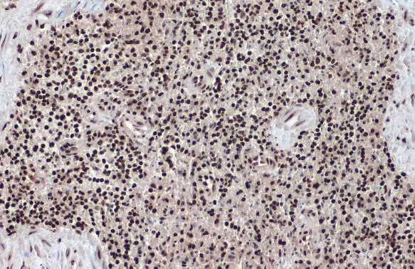 Histone H2A.Z antibody detects Histone H2A.Z protein at nucleus by immunohistochemical analysis. Sample: Paraffin-embedded cat spleen. Histone H2A.Z stained by Histone H2A.Z antibody (GTX108273) diluted at 1:500. Antigen Retrieval: Citrate buffer, pH 6.0, 15 min
